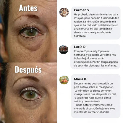 YCZ™ EyeLift Pro — Reduce Bolsas y Rejuvenece tu Mirada
